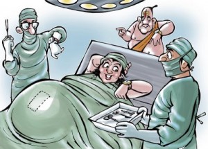 c-section